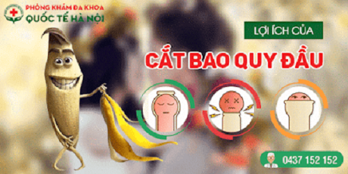 Lợi ích của cắt bao quy đầu 