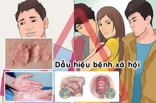 Các bệnh xã hội thường gặp