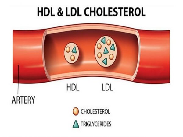 Chi so IDL cholesterol la gi